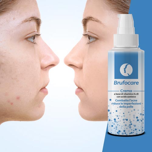 crema anti ostruzione dei pori